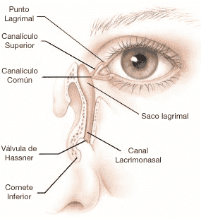 Comment déboucher le canal lacrymal chez l'adulte ?