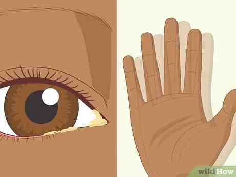 Comment décongestionner les glandes lacrymales ?