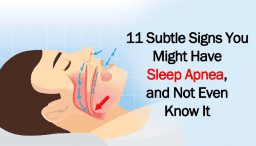 Est-ce que l'apnée du sommeil peut disparaître ?